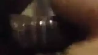 تجميع العمل الشرجي المدقع